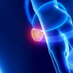 La prévention du cancer de la prostate : conseils et dépistage
