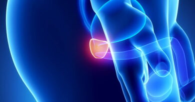 La prévention du cancer de la prostate : conseils et dépistage