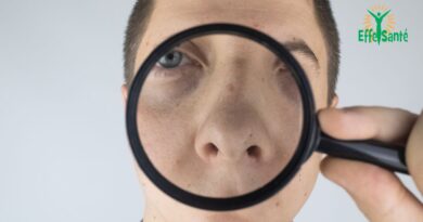 Comment traiter efficacement les comédons ?