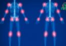 Trois Aliments Nocifs pour les Articulations