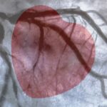Les arythmies cardiaques : Comprendre les irrégularités du rythme cardiaque