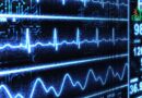 Les Types des Arythmies Cardiaques