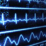 Les Types des Arythmies Cardiaques