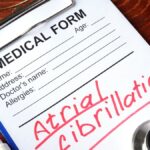 Comprendre la Fibrillation Auriculaire