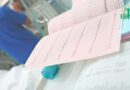 Tachycardie Supraventriculaire : Un Regard Approfondi sur cette Arythmie Cardiaque