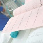 Tachycardie Supraventriculaire : Un Regard Approfondi sur cette Arythmie Cardiaque