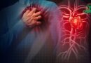 Bloc Auriculo-Ventriculaire : Trouble du Rythme Cardiaque