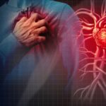 Bloc Auriculo-Ventriculaire : Trouble du Rythme Cardiaque