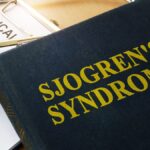 Syndrome de Sjögren : Comprendre cette Maladie Auto-immune