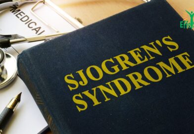 Syndrome de Sjögren : Comprendre cette Maladie Auto-immune