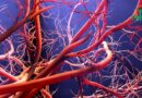 La maladie de Behçet : une pathologie inflammatoire systémique
