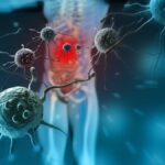 Maladies auto-immunes: comprendre et gérer