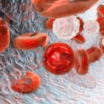 Anémies : Comprendre, Diagnostiquer et Traiter