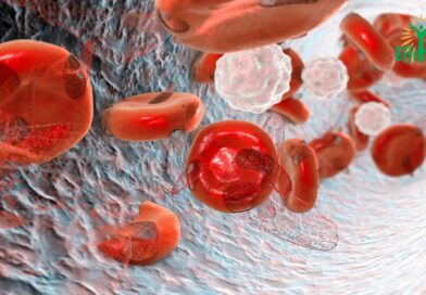 Anémies : Comprendre, Diagnostiquer et Traiter