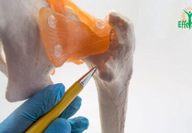 Chirurgie du Fémur: Comprendre le Fixateur d&rsquo;Ilizarov