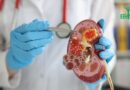 Insuffisance Rénale: Causes, Symptômes, Diagnostic et Traitement