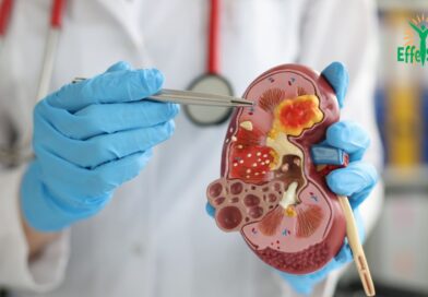 Insuffisance Rénale: Causes, Symptômes, Diagnostic et Traitement