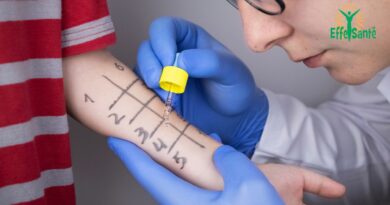 Allergologie: son rôle