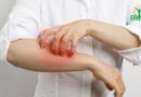 Dermatologie: son rôle
