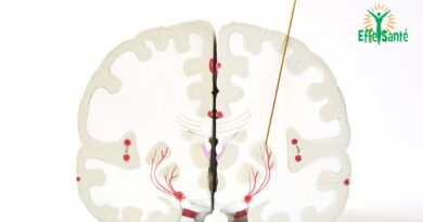 Alimentation et la Maladie de Parkinson