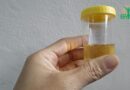 Infection Urinaire : Causes, Symptômes et Traitements