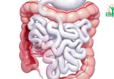 La colopathie fonctionnelle : Comprendre et Gérer