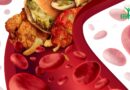 Cholestérol : L&rsquo;autre épidémie silencieuse