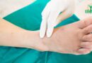Neuropathie diabétique : Faits rares et surprenants