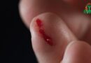 D&rsquo;où provient le sang lors d&rsquo;une blessure : veine ou artère?