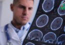 Sclérose en plaques et épilepsie : Comment gérer ces deux conditions simultanément?