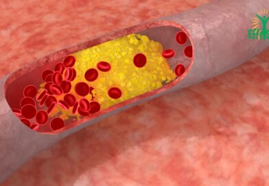 Hypercholestérolémie Familiale : Une Lutte Génétique Contre le Cholestérol ⚖️🧬