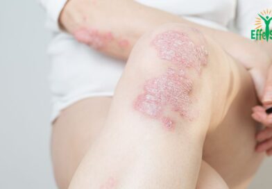 Les Mystères des Maladies Auto-immunes : Origines, Mécanismes et Stratégies de Gestion