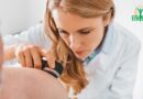 Cancer de la peau: Comprendre et gérer