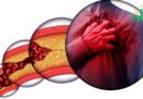 signes précurseurs maladie cardiaque, douleur thoracique, essoufflement, consultation médicale pour maladie cardiaque