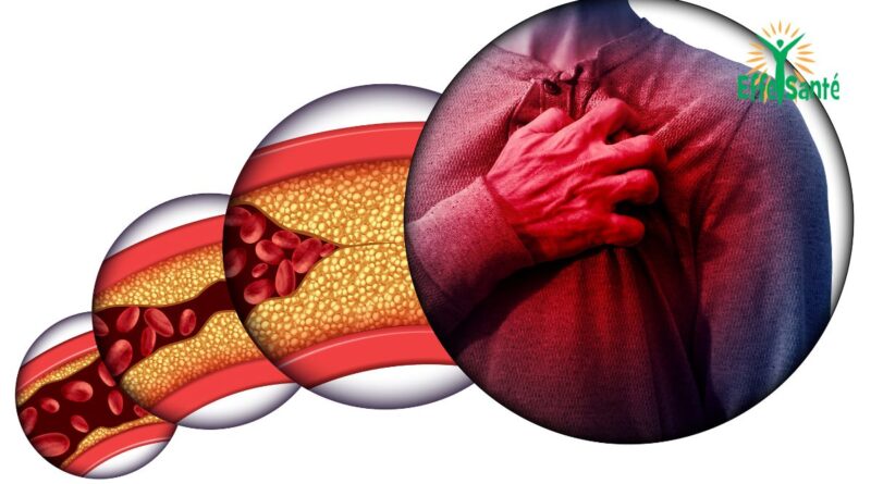 signes précurseurs maladie cardiaque, douleur thoracique, essoufflement, consultation médicale pour maladie cardiaque