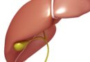 Dilatation des voies biliaires : Pourquoi et Comment