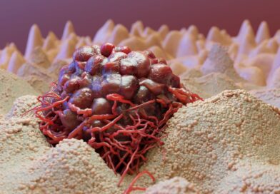 L&rsquo;Immunothérapie : Quand votre corps devient votre meilleur allié